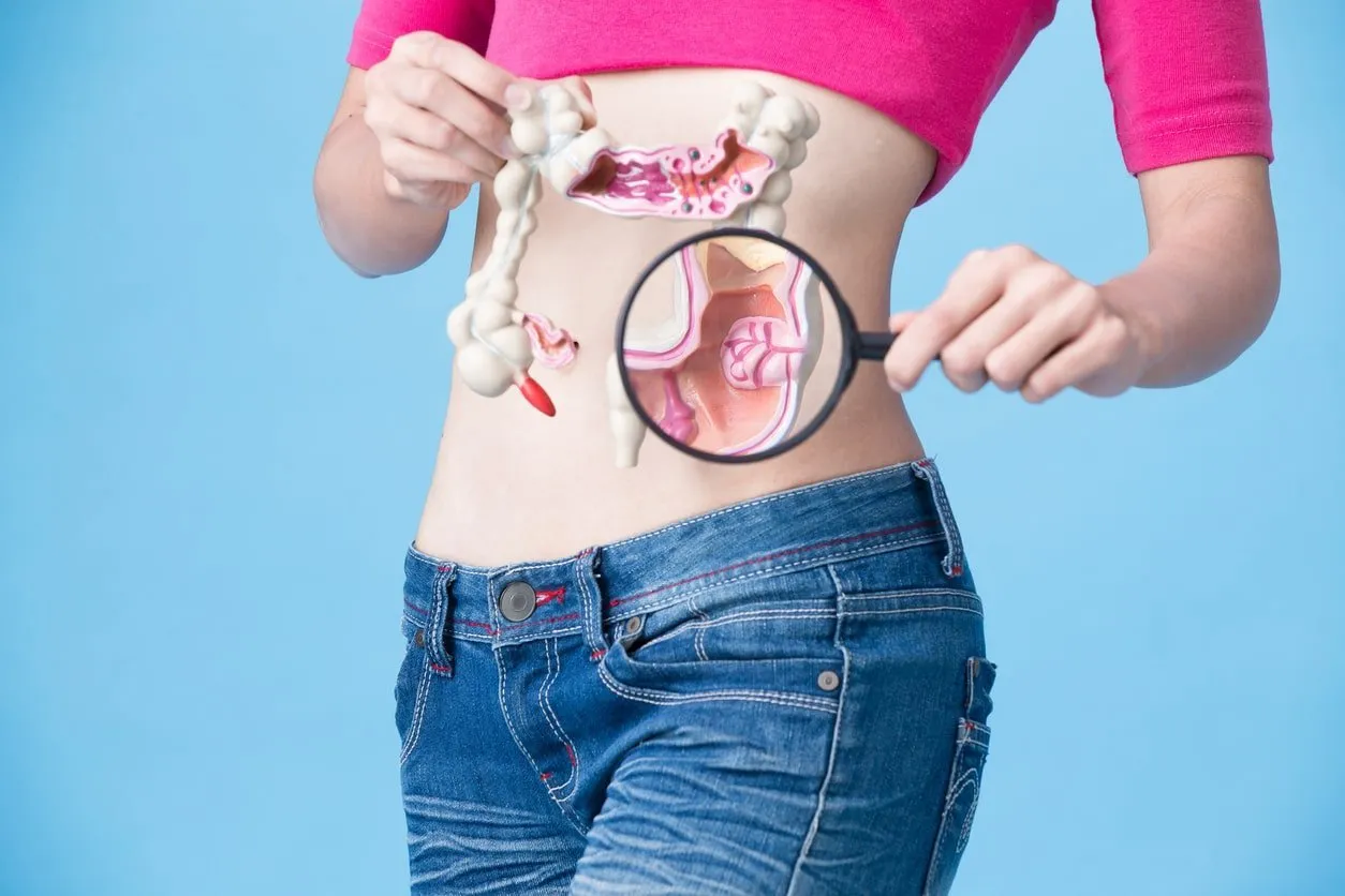 Colon Cancer